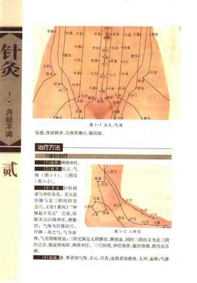 针灸治疗常见病证图解_妇-儿科分册_张建华.pdf