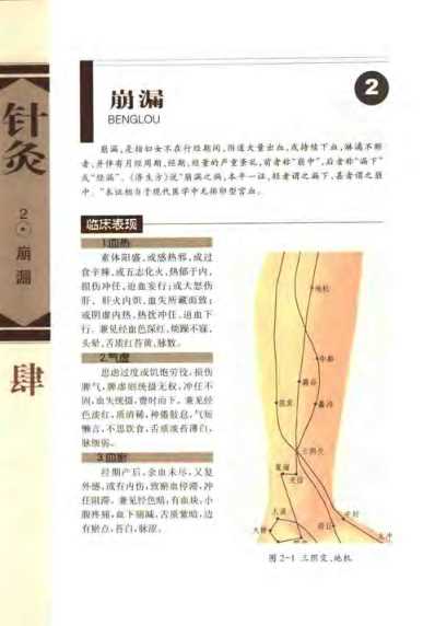 针灸治疗常见病证图解_妇-儿科分册_张建华.pdf